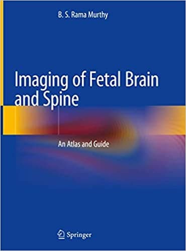 Imaging of Fetal Brain and Spine 1st/2019