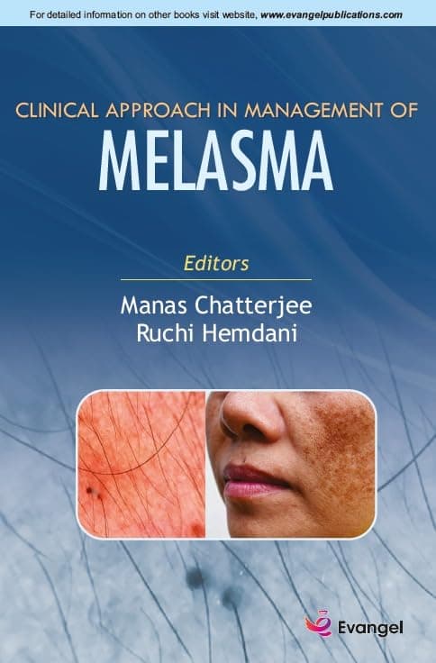 Clinical Approach in Management of Melasma 1st/2024