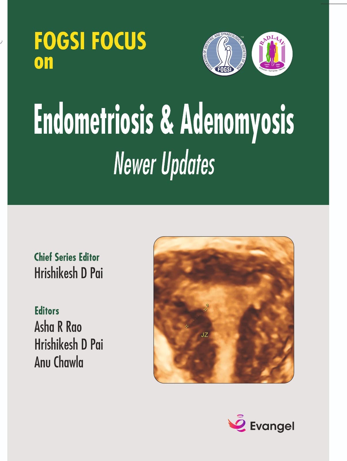 FOGSI Focus on Endometriosis & Adenomyosis 1st/2024