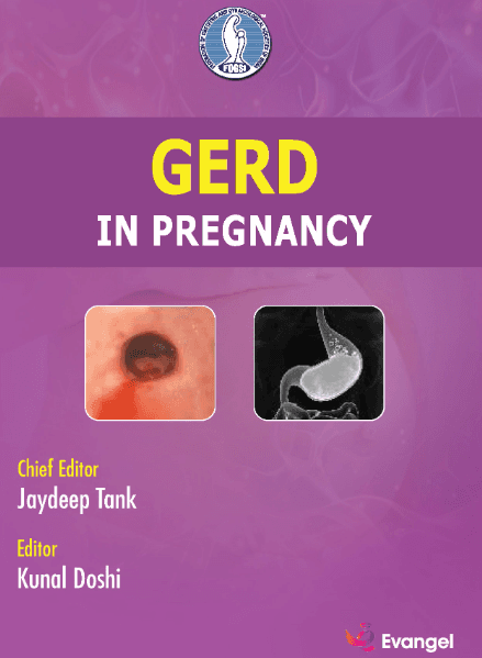 GERD in pregnancy 1st/2025