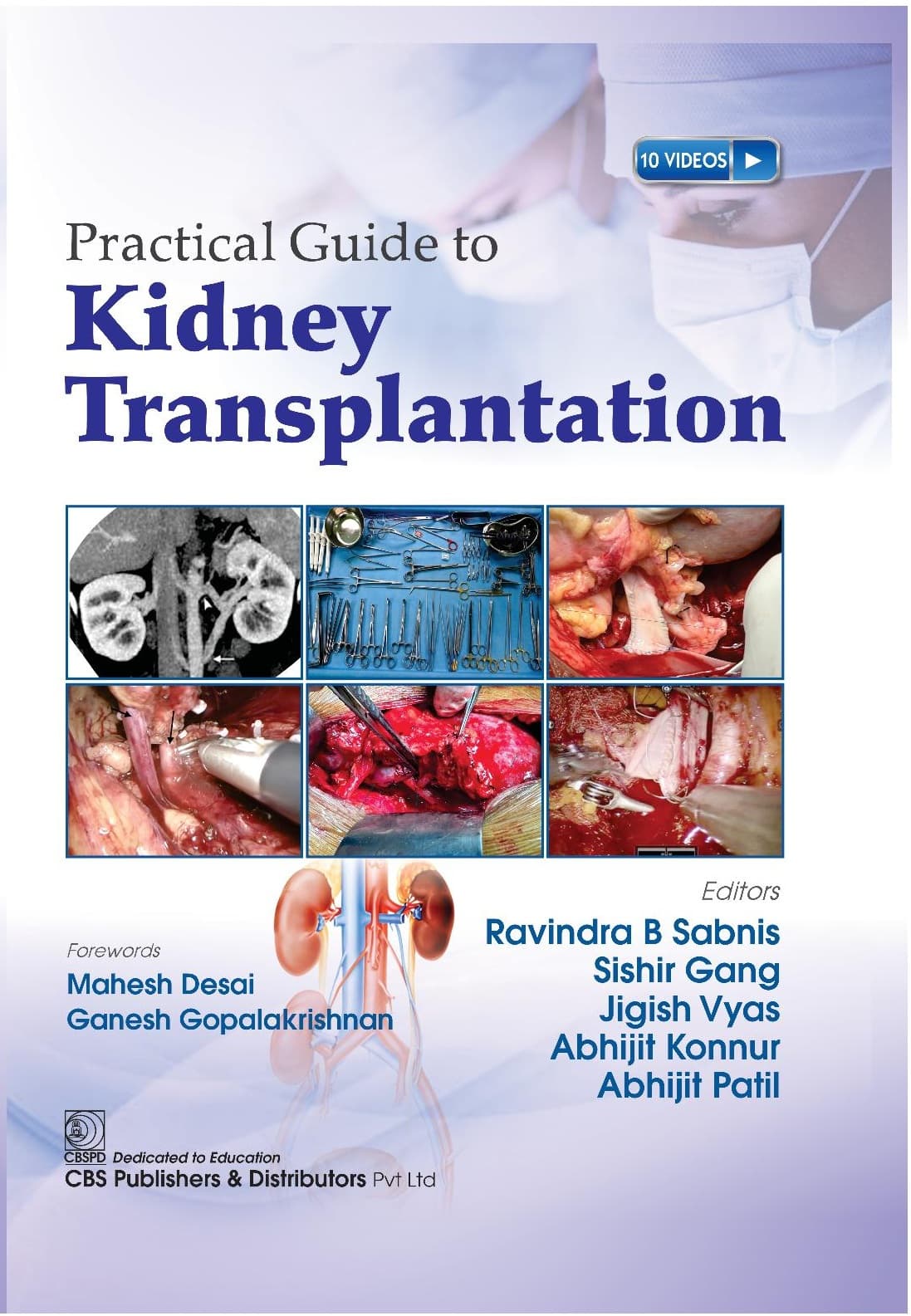 Practical Guide to Kidney Transplantation 1st/2025