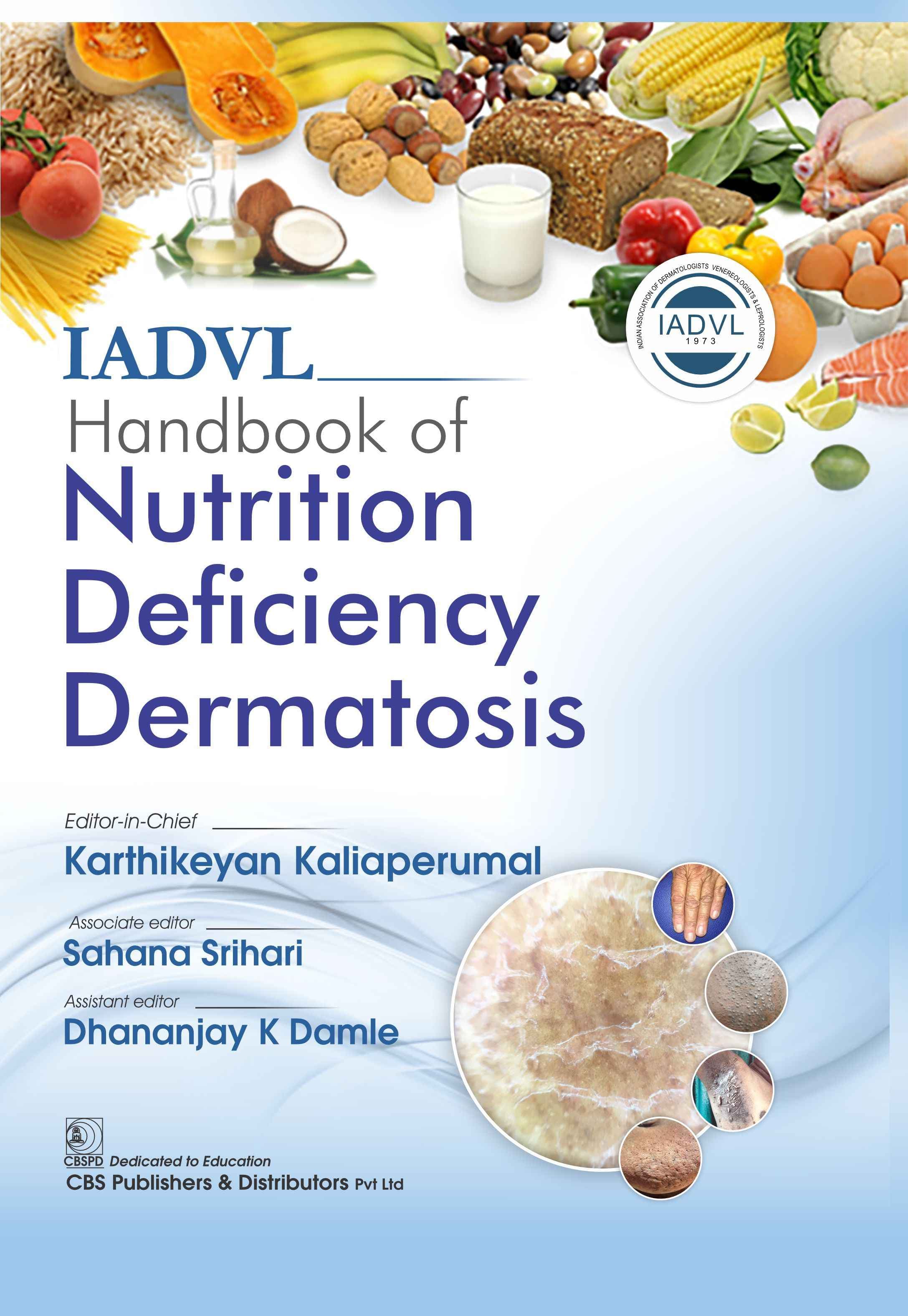 IADVL Handbook of Nutrition Deficiency Dermatosis 1st/2025