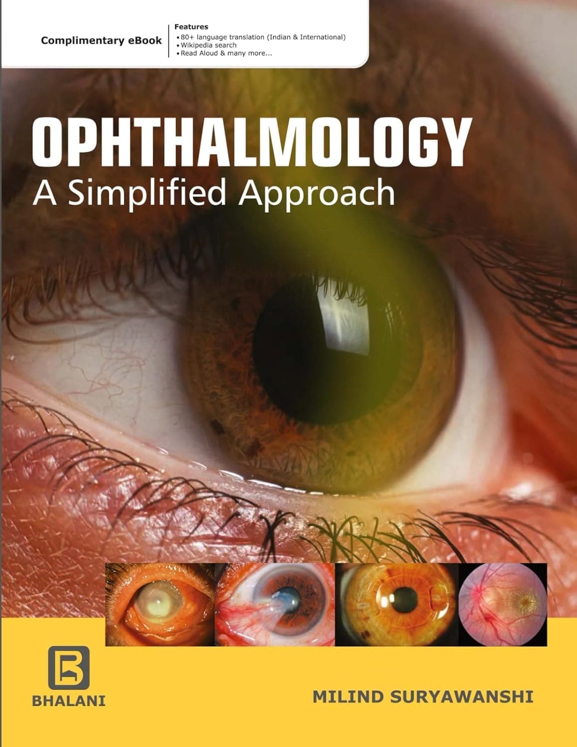 Ophthalmology A Simplified Approach 1st/2025