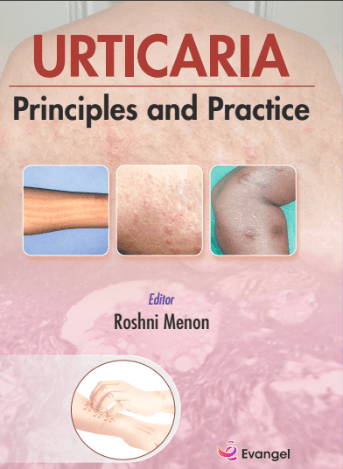 Urticaria Principal and Practice 1st/2026