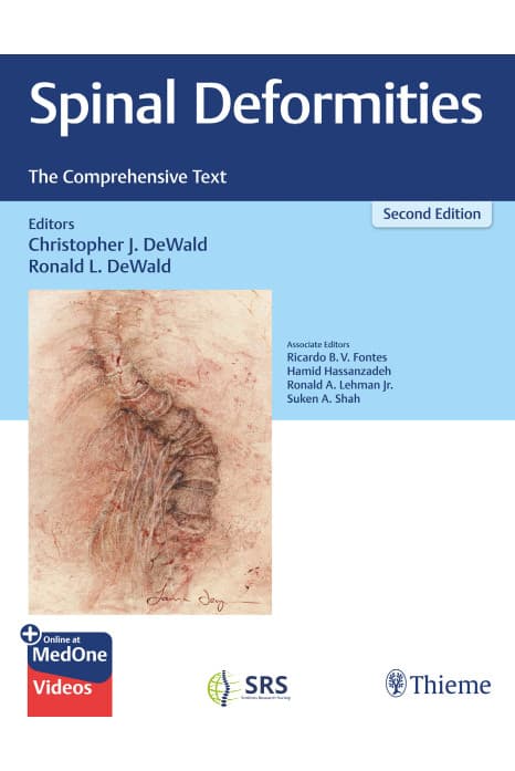 Spinal Deformities The Comprehensive Text 2nd/2024