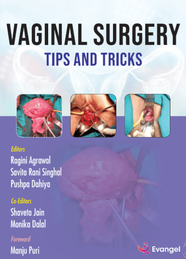 Vaginal Surgery Tips and Tricks 1st/2025