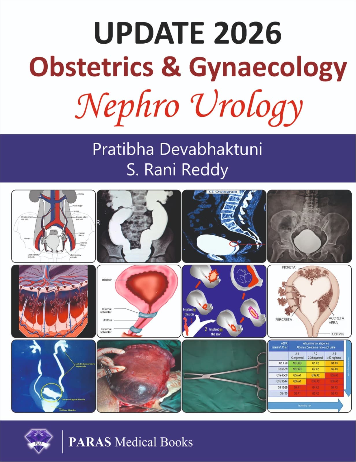 Update 2026 Obstetrics and Gynaecology: Nephro Urology 1st/2026