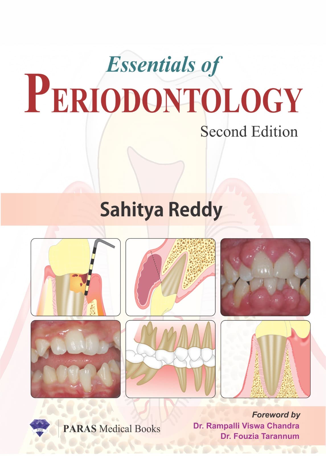 Essentials of Periodontology 2nd/2026