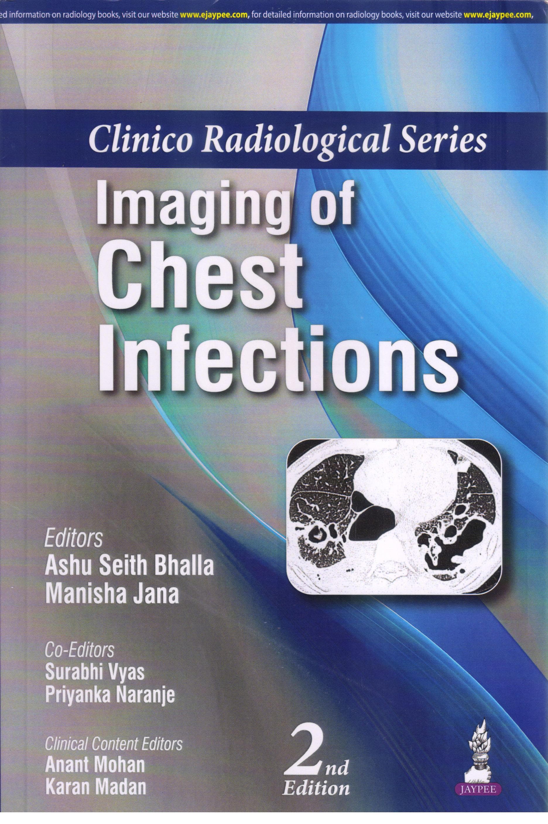 Clinico Radiological Series Imaging of the Chest Infections 2nd/2026
