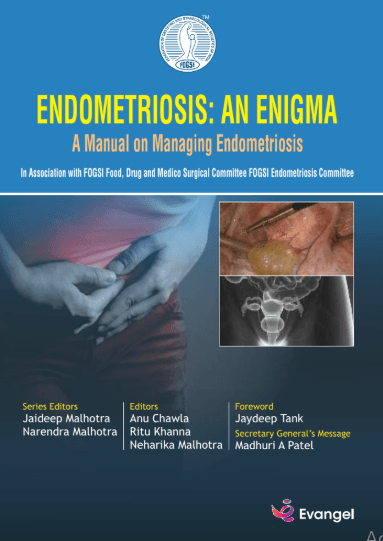 FOGSI Endometriosis An Enigma 1st/2025