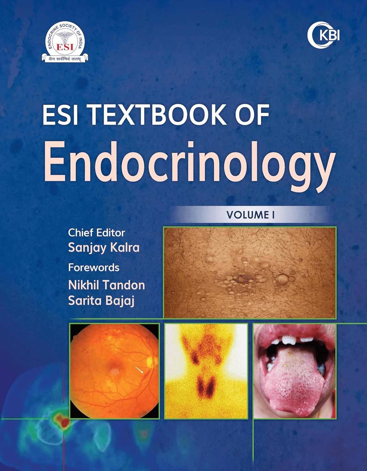 ESI Textbook of Endocrinology 1st/2025 (2 Vols)