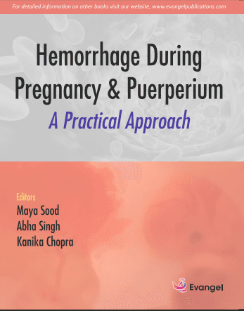 Hemorrhage During Pregnancy & Puerperium: A Practical Approach 1st/2026