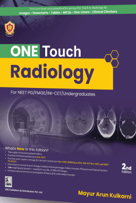 One Touch Radiology for NEET PG/FMGE/INI-CET/Undergraduates 2nd/2026