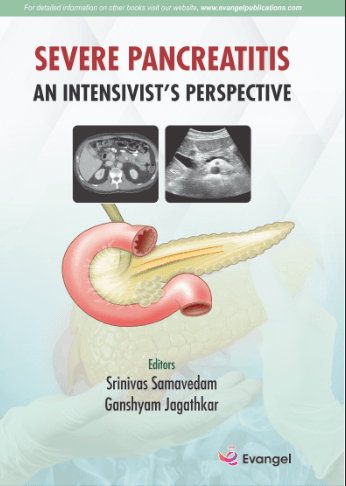 Severe Pancreatitis An intensivist's Perspective 1st/2026