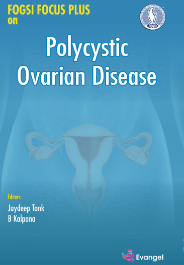FOGSI Focus Plus on Polycystic Ovarian Disease 1st/2025