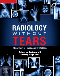 Radiology Without Tears Mastering Radiology OSCEs 1st/2024