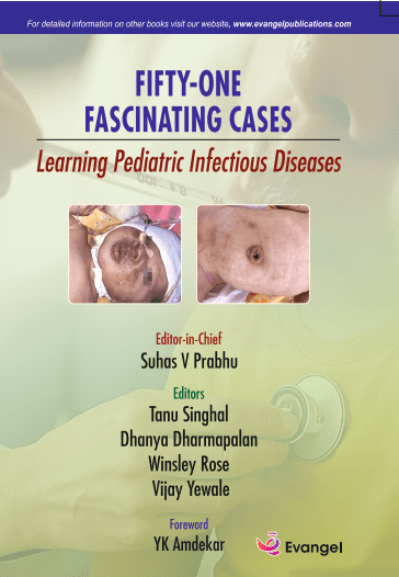 Fifty One Fascinating Cases: Learning Pediatric Infectious Diseases 1st/2026