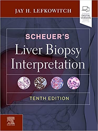 Scheuer's Liver Biopsy Interpretation 10th/2020