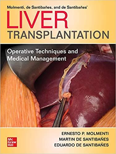 Liver Transplantation: Operative Techniques and Medical Management 1st/2021