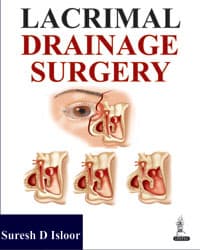 Lacrimal Drainage Surgery 1st/2014