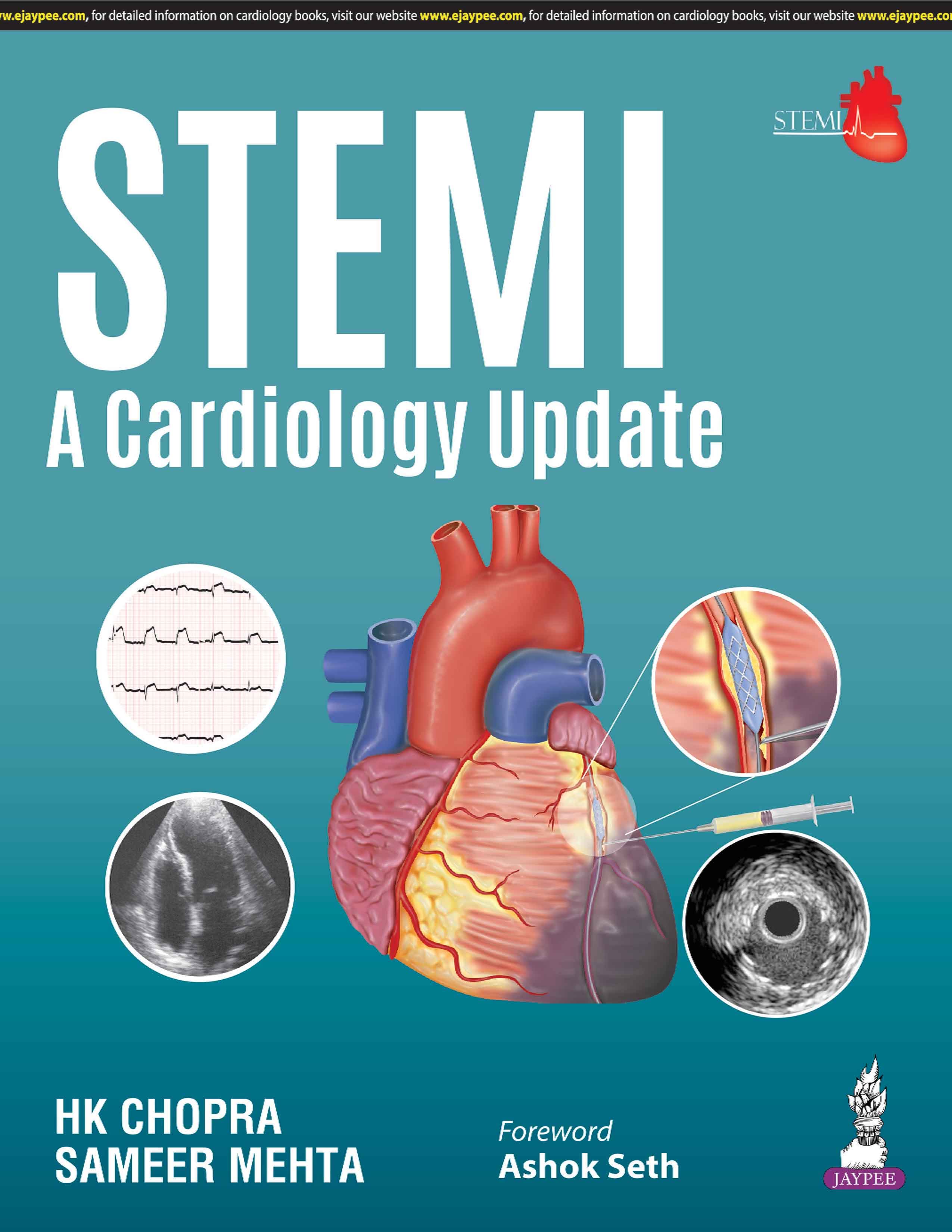 STEMI A Cardiology Update 1st/2025