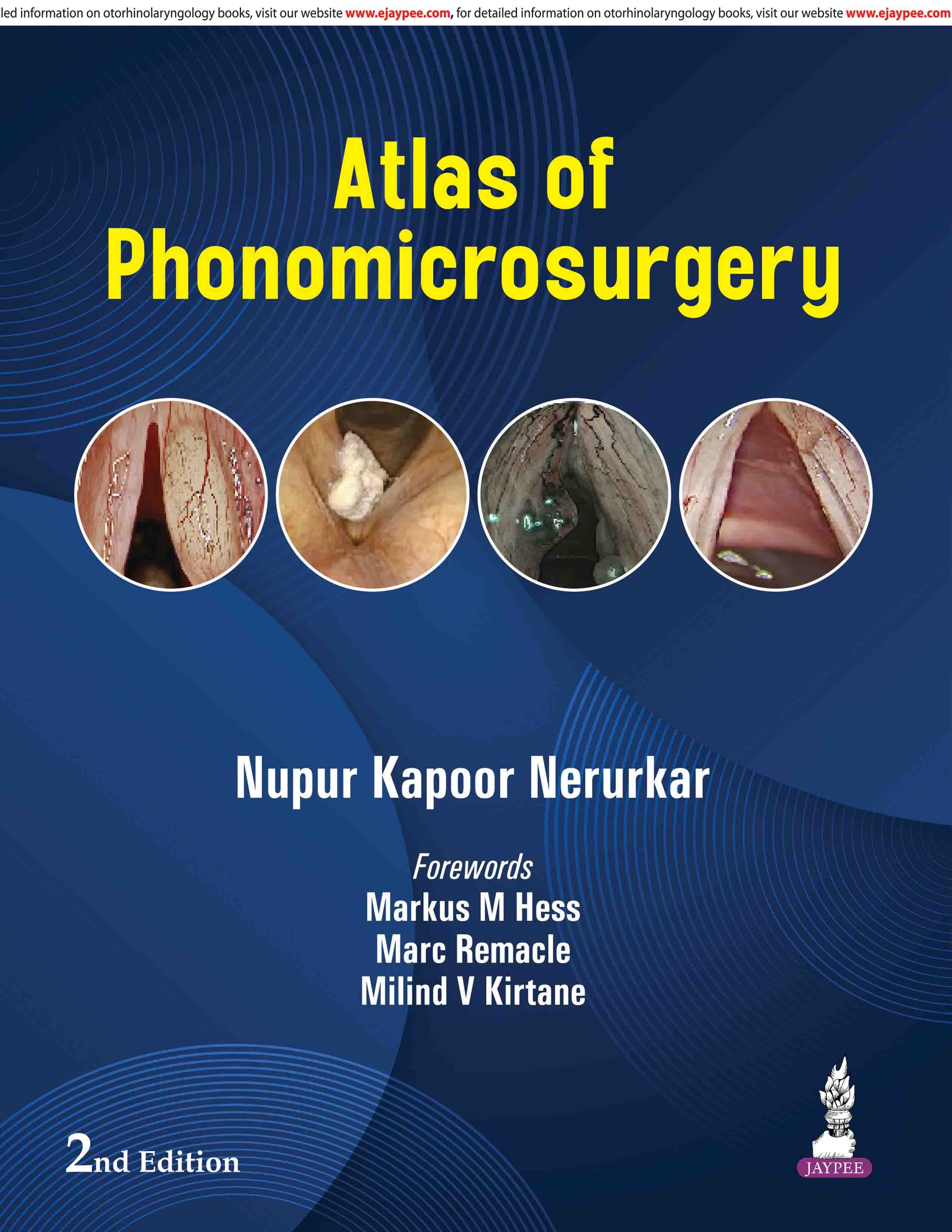 Atlas of Phonomicrosurgery 2nd/2026