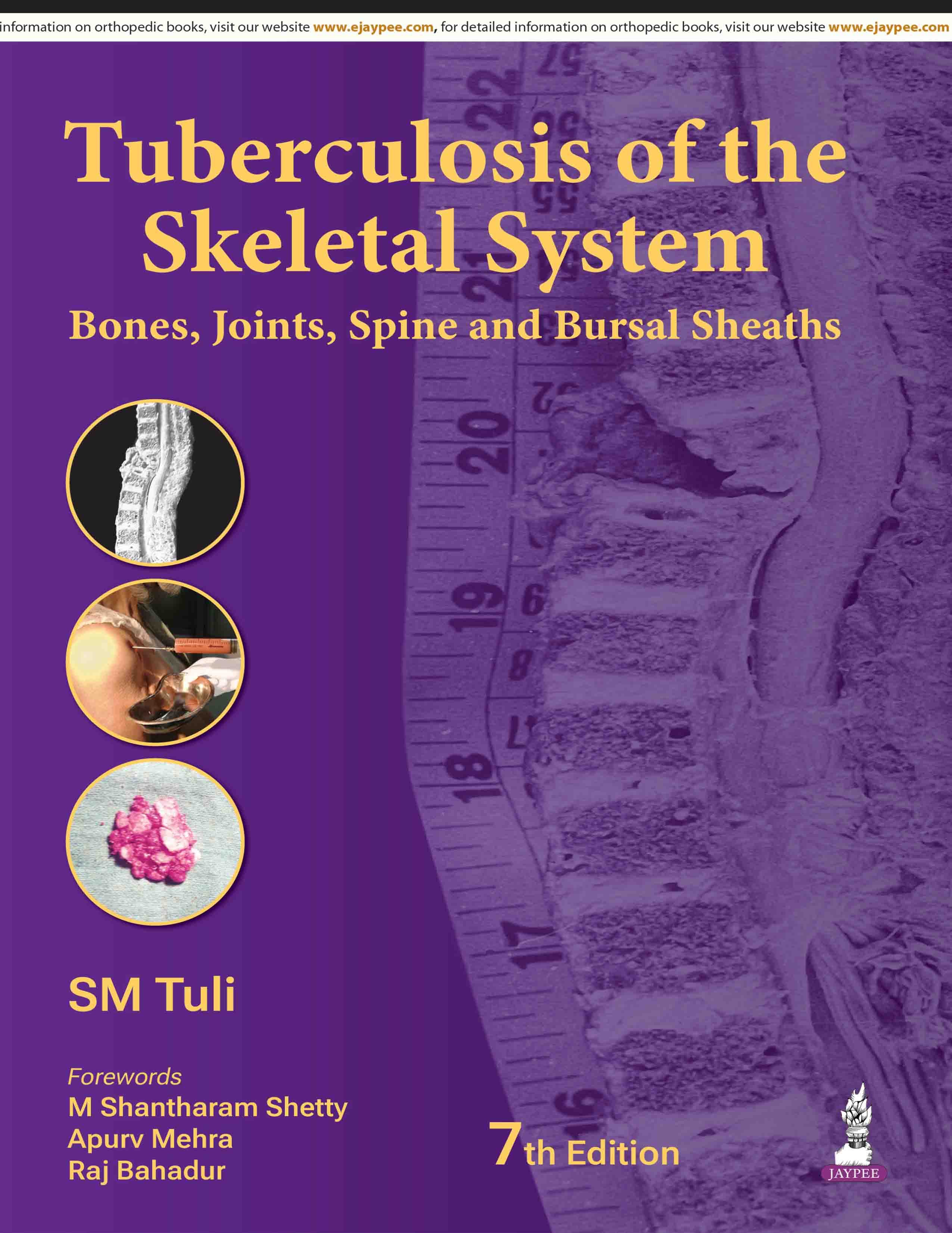 Tuberculosis of the Skeletal System 7th/2026