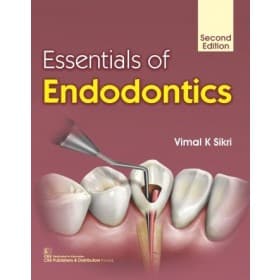 Essentials of Endodontics 2nd/2018