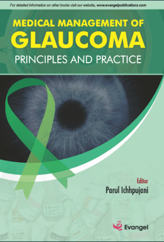 Medical Management of Glaucoma Principles and Practice 1st/2026